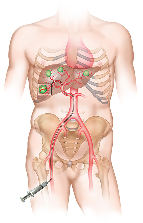 Cra Imaging Torso Anatomy